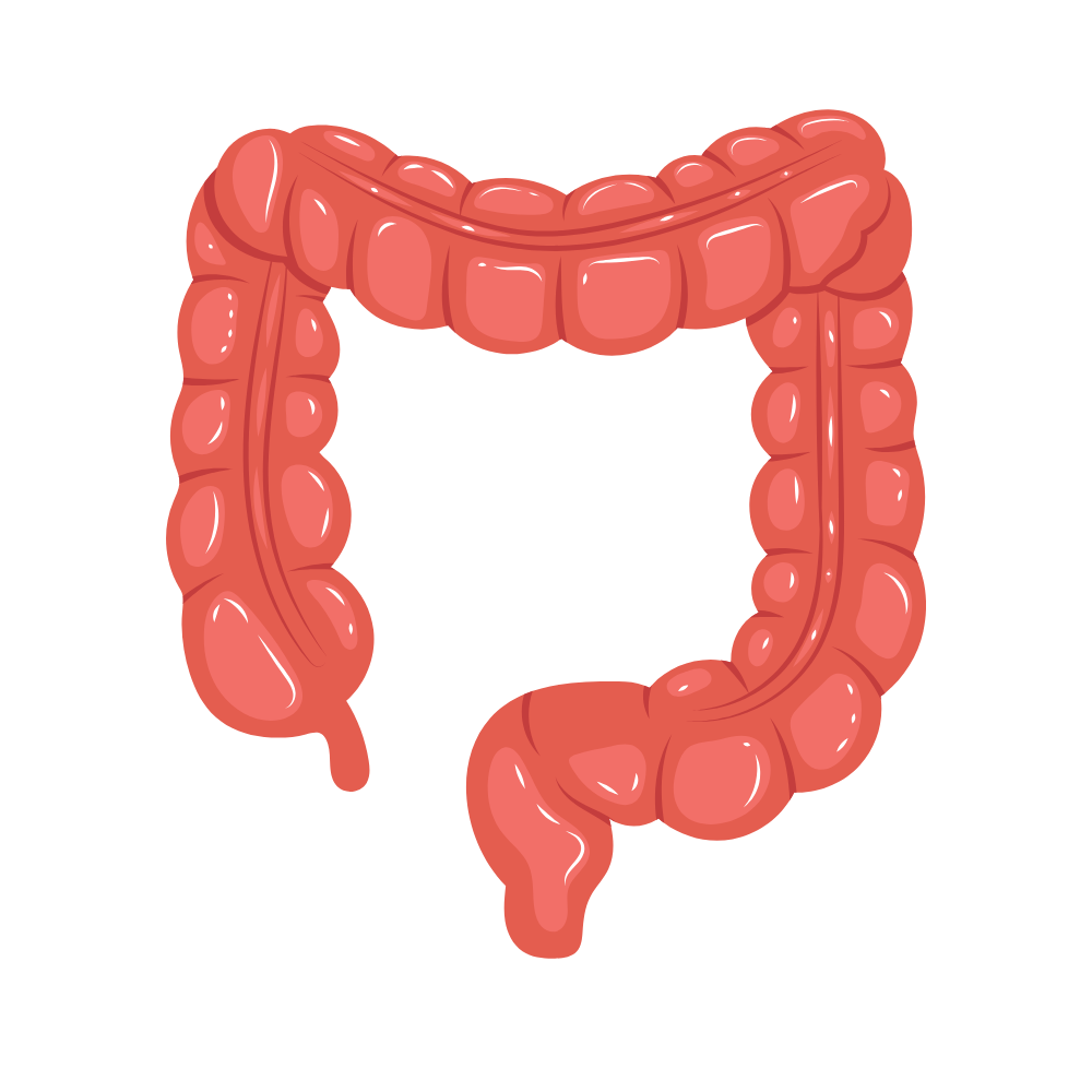 Cáncer colorrectal