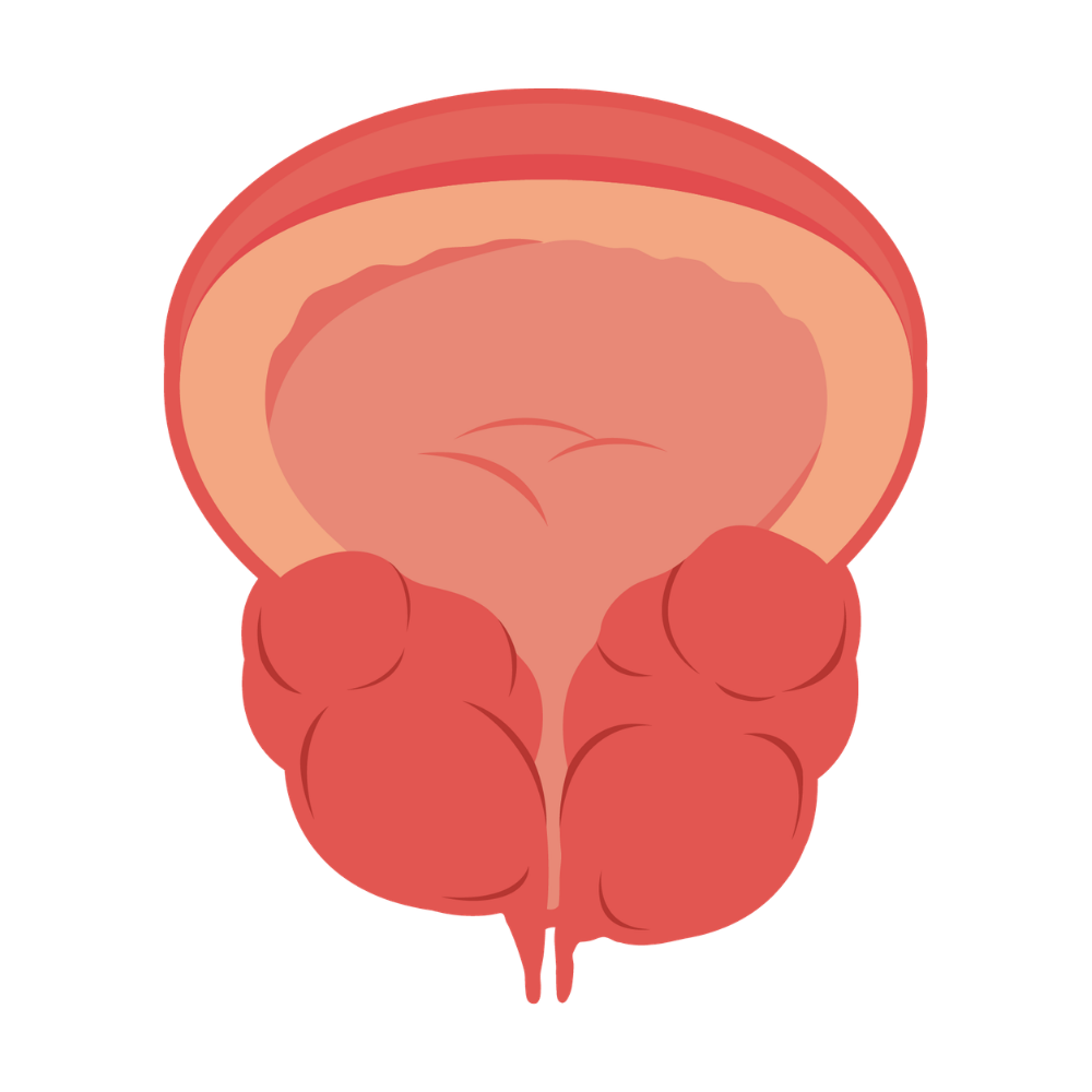 Cáncer de próstata