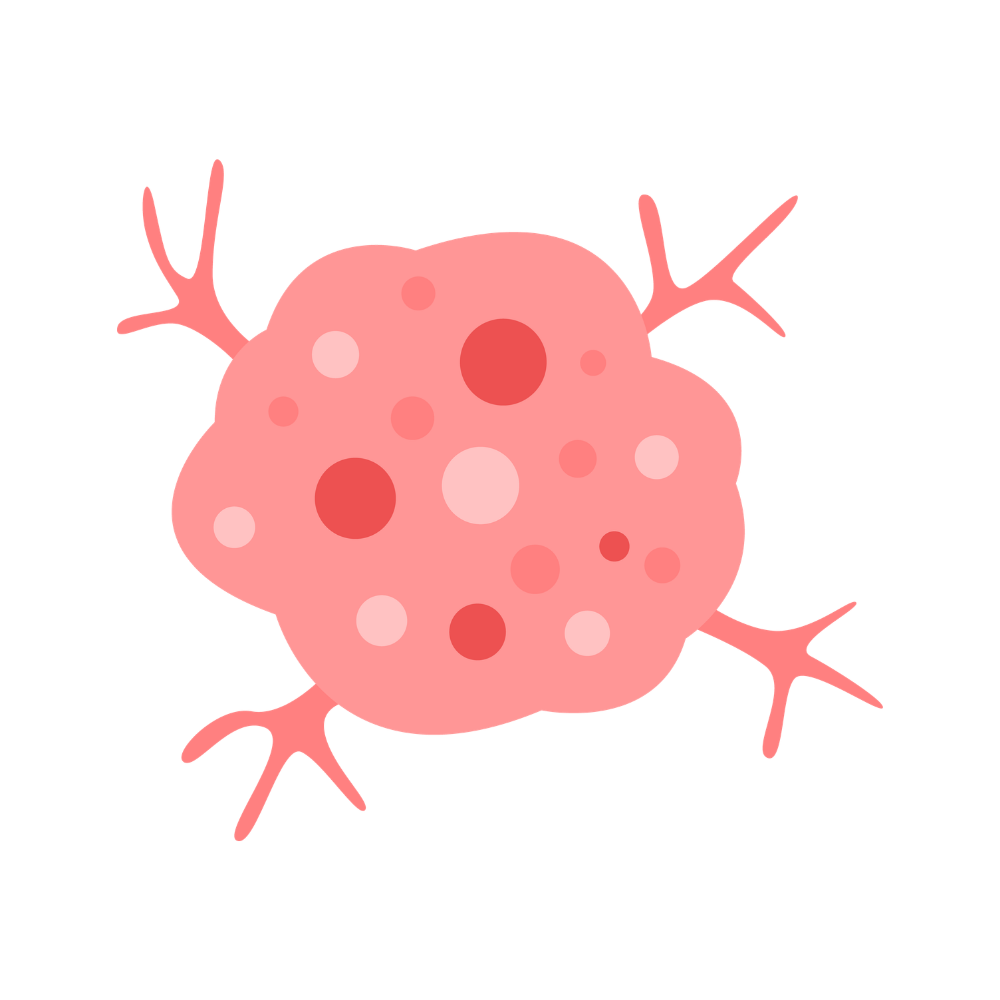 Sarcomas