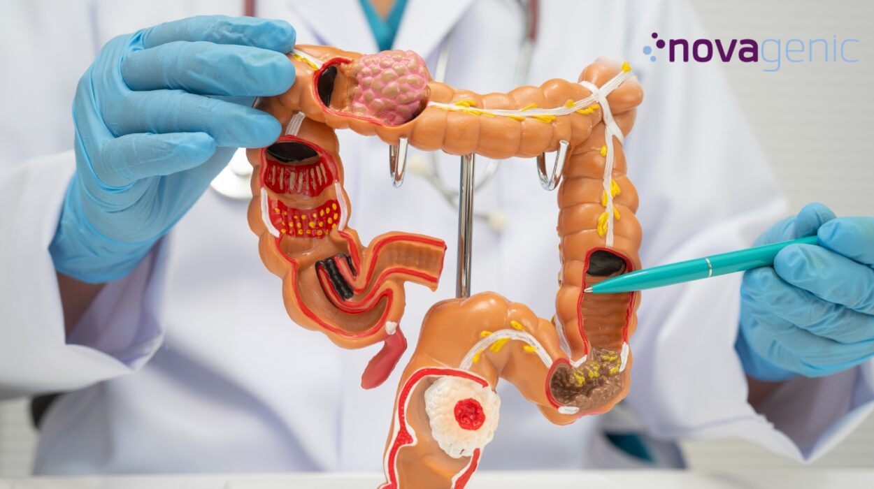 Farmacogenética en cáncer colorrectal y medicina de precisión